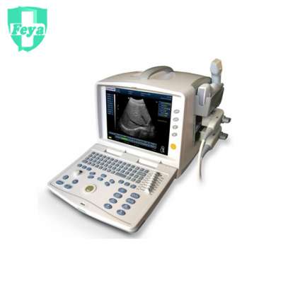 FY-3300 2d Portable Ultrasound Scanner Machine China Price