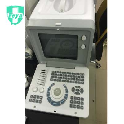 FY-SS-5 Prices of Cheapest Portable Ultrasound Machine