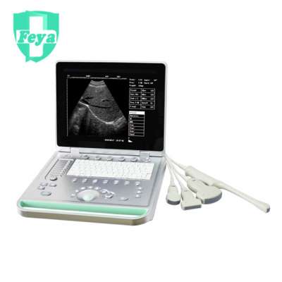 FY-SS-9 PC Ultrasound Scanner Portable Laptop