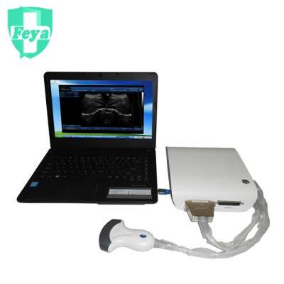 FY-Ubox-10 Black & White Ultrasound Scanner Box (Connect to PC)