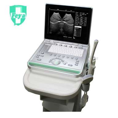 FY-SS-9 3D Ultrasound Machine Color Doppler Ultrasound Price