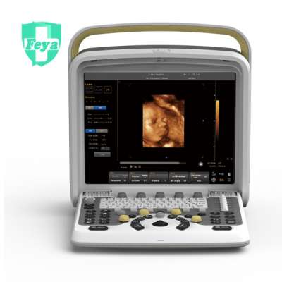 FY-Q5 Prices of Portable Color Doppler 2D 4D Ultrasound Scanner Machine