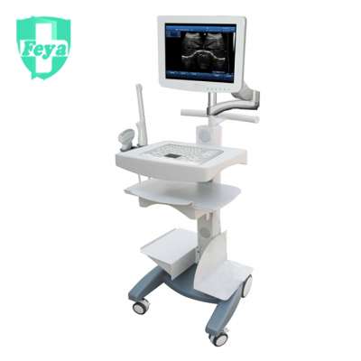 FY-SS-100 Touch Screen Trolley Black & White Ultrasound Scanner