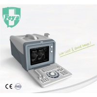 FY-SS-5 Cheap Stable Portable Black & White Ultrasound Scanner