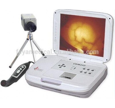 FY-8100A Potable Infrared Breast Diseases Diagnostic Machine