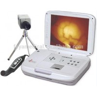 FY-8100A Potable Infrared Breast Diseases Diagnostic Machine