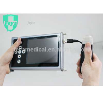 FY-V3 Palm Size Portable Vet Ultrasound Device