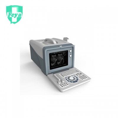 FY-SS-5 Cheapest Portable Ultrasound Scanner Machine Price