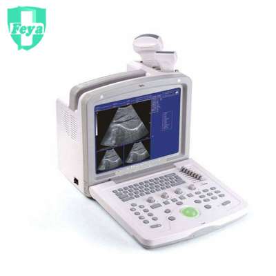 FY-160 PC Based 12" Inch LCD Screen Full Digital Black & White Ultrasound Scanner China Supplier