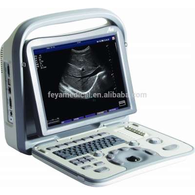 FY-A6V Portable Lightweight Black & White Ultrasound Scanner For Vet Use