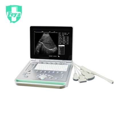 FY-SS-7 China Portable Laptop Ultrasound Machine Price Sale