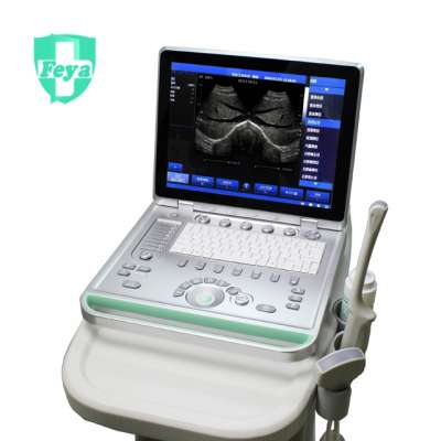 FY-SS-8 15" LED ARM Based Laptop Black & White Ultrasound Scanner