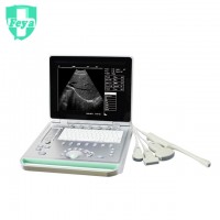 FY-SS-9 15" LED PC Based 3D Laptop Black & White Ultrasound Scanner