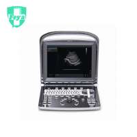 FY-ECO1VET Animal's Portable Fully Digital Black & White Ultrasound Scanner