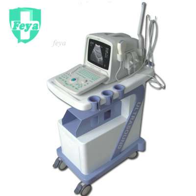 FY-SS-6 Popular Portable Black & White Ultrasound Scanner