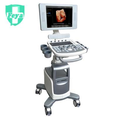 FY-QBit 7 General Trolley Type 15" LED Screen Rotating Color Doppler Ultrasound Machine