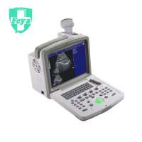 Ultrasound Scanner (Full digital ultrasonic diagnostic system)