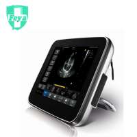 FY-ST30 Touch Screen Laptop Color Doppler Ultrasound Machine