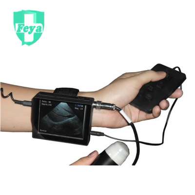 FY-V2 Veterinary Wrist Ultrasound Scanner