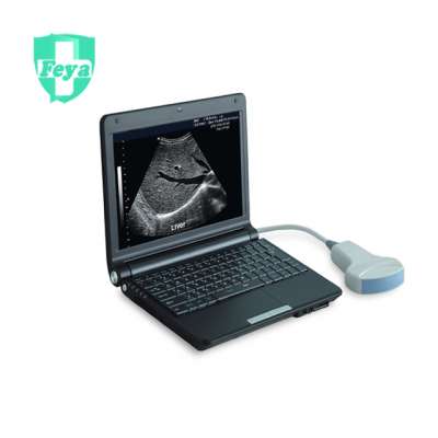 Laptop Full Digital Black & White Veterinary Ultrasound Scanner